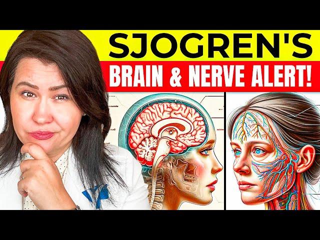 Can Sjogren's Affect Your Brain? What Every Patient Needs to Know!