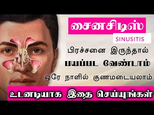 சைனசிடிஸ் வந்தால் உடனடி தீர்வு தரும் வைத்தியம் | Next Day 360