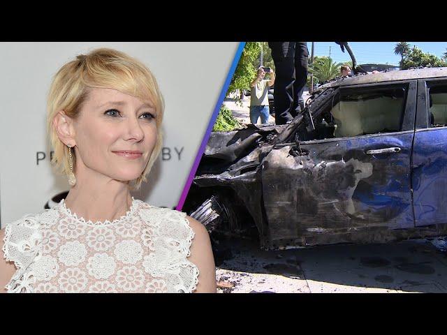 Anne Heche Car Crash: Doctor Explains Her Burn Injuries