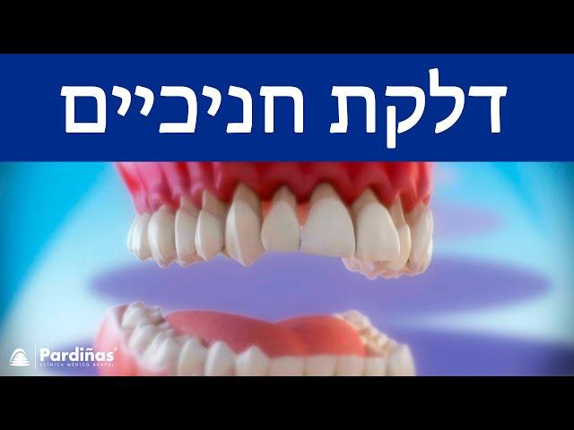 © דלקת חניכיים - מה זה