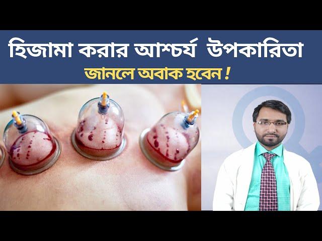 হিজামা বা কাপিং এর আশ্চর্যজনক কিছু উপকারিতা - Health benifits of Hijama cuppung therapy