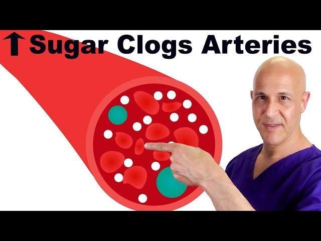 Prevent High Blood Sugar from Causing Clogged Arteries | Dr. Mandell