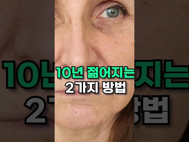 또래보다 확 어려보이는 처진 얼굴 올리는 법 #써마지 #울쎄라 #처진얼굴올리기
