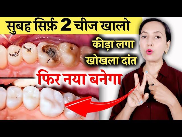 सुबह सिर्फ़ 2 चीज खालो सड़ा कीड़ा लगा खोखला दांत भी फिर से नया बनेगा | Teeth Cavity