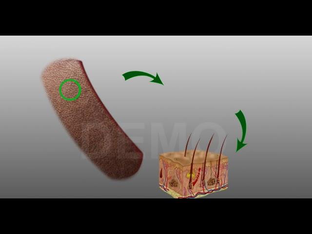 Hair Transplantation procedure