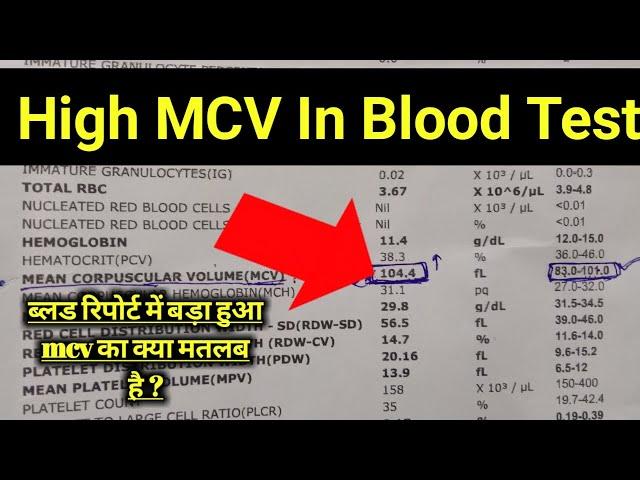 Mcv Blood Test In hindi || Mcv Test || Mcv High In Blood Test || Mcv Blood Test Results