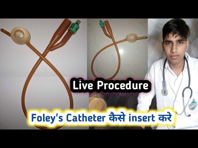 Foley's Catheter Insertion Procedure  Step By Step Catheter Insertion Procedure