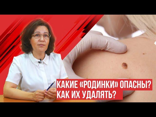 Какие родинки нужно удалять и как?