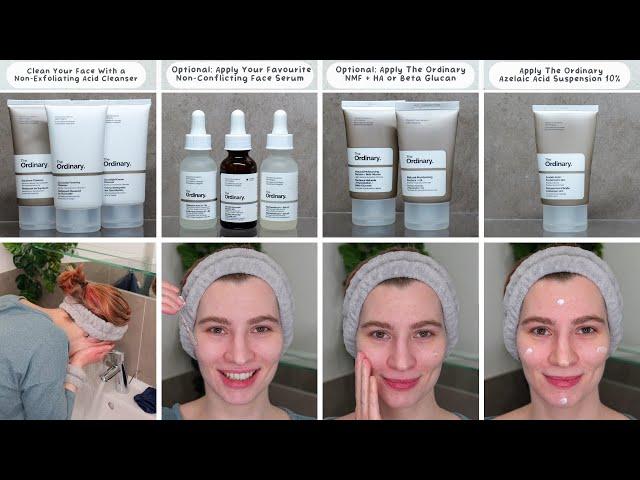 How to use The Ordinary Azelaic Acid Suspension 10%