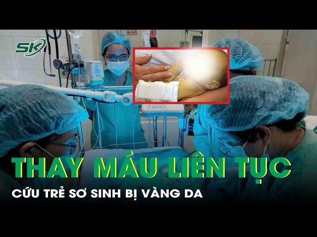 Chạy đua thời gian cứu sống trẻ sơ sinh bị vàng da | SKĐS