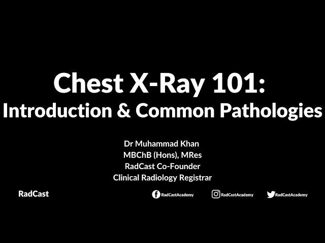 RadCast Academy: Introduction To The Chest X-Ray & Common Pathologies #cxr #radcast