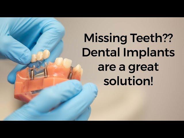 Options for replacing missing teeth with dental implants | Durham Dental Solutions