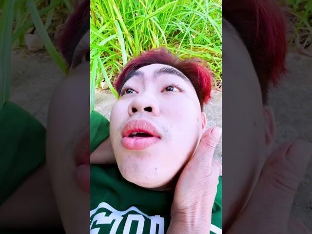 Bệnh TTTT là bệnh gì nhỉ #nmtvlog