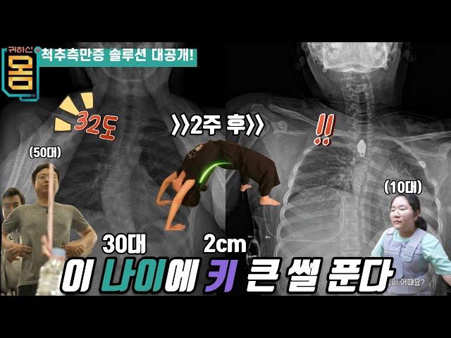 [Full] 귀하신 몸 - 23화 척추측만증, 당신의 척추는 몇 도입니까?