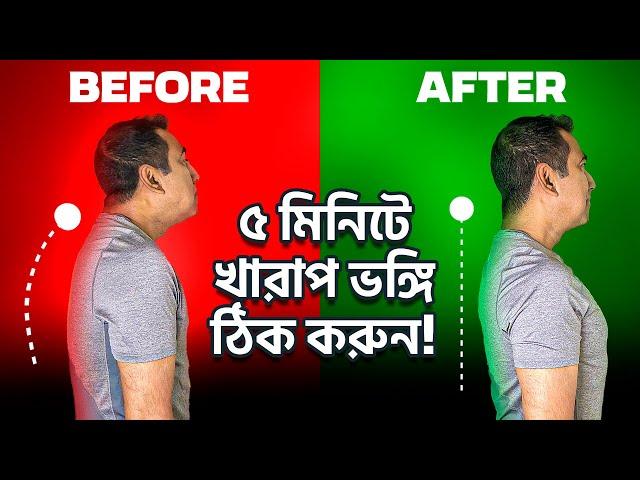 ভঙ্গি (Posture) সংশোধন করার সহজ উপায় ৷ ঘাড়ব্যথা, কাঁধেব্যথা কমবে 5 Best Exercises To Fix Posture