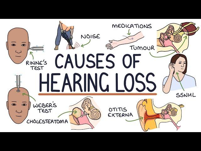 Understanding the Causes of Hearing Loss