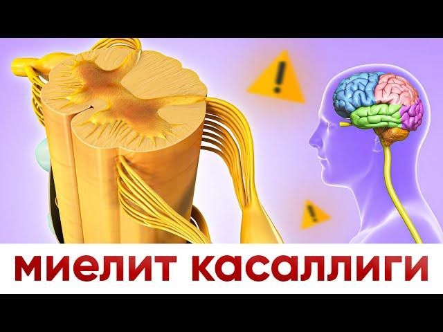 миелит  касаллиги | сабаблари | даволаш усуллари...