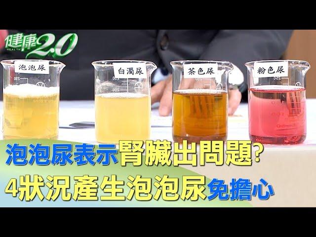 泡泡尿表示腎臟出問題？4狀況產生泡泡尿免擔心 健康2.0