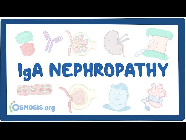 IgA nephropathy - causes, symptoms, diagnosis, treatment, pathology