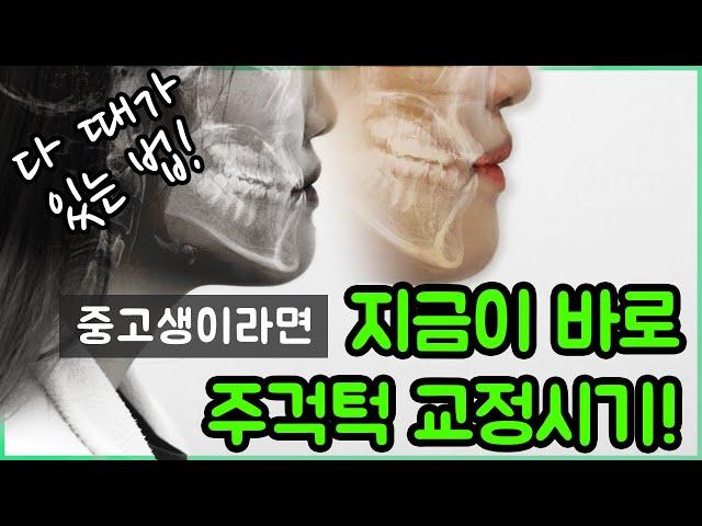 고등학생의 턱 교정 이야기 | 다 때가 있는 법! 중, 고등 학생이라면 지금이 바로 주걱턱 교정시기!