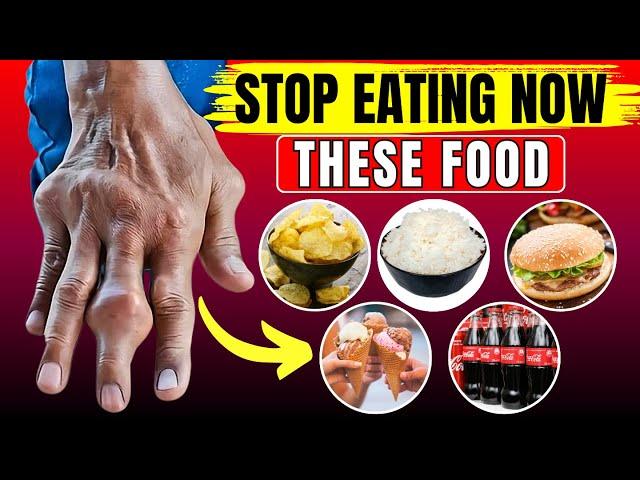 STOP NOW! 15 Most Dangerous Foods for Arthritis You Must Avoid || HealthQuest