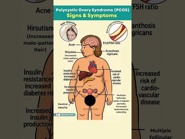 PCOS Signs & Symptoms - What Every Woman Should Know