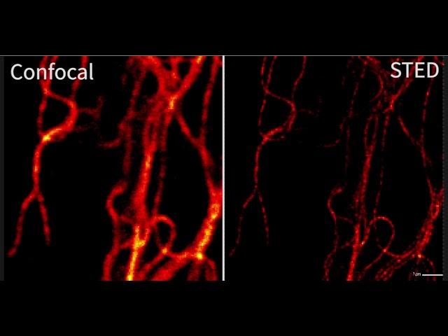 Конфокальные и STED изображения. 1.5 часа съемки (100 кадров) - 1 область