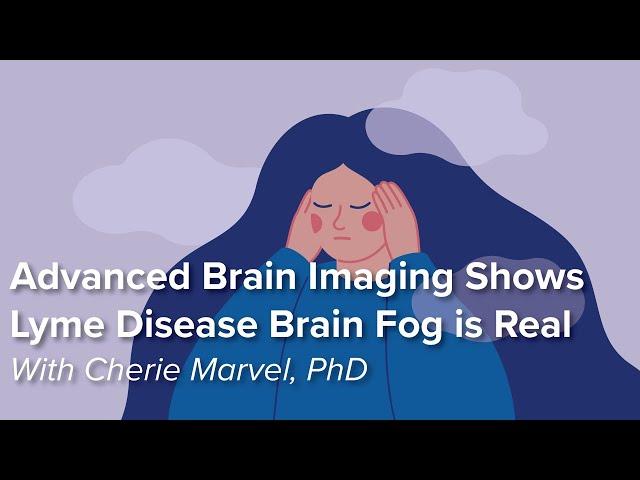 Advanced Brain Imaging Shows Lyme Disease Brain Fog is Real | Johns Hopkins Rheumatology