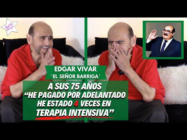 EDGAR VIVAR: "Pesaba casi 170 KILOS, pero ahora  ¡ya bajé 100! / Entrevista con Matilde Obregón.