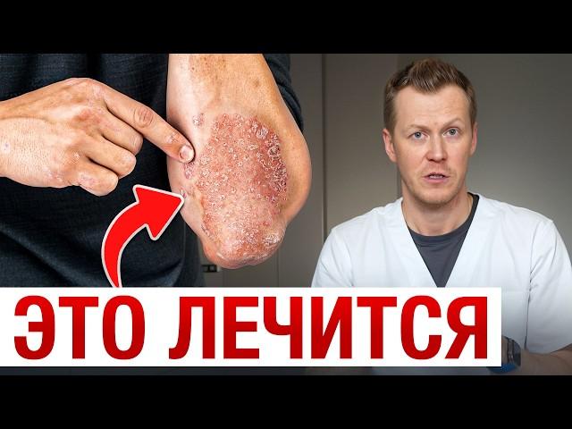 Кожные заболевания уйдут МОМЕНТАЛЬНО! / РЕАЛЬНЫЕ причины кожных высыпаний