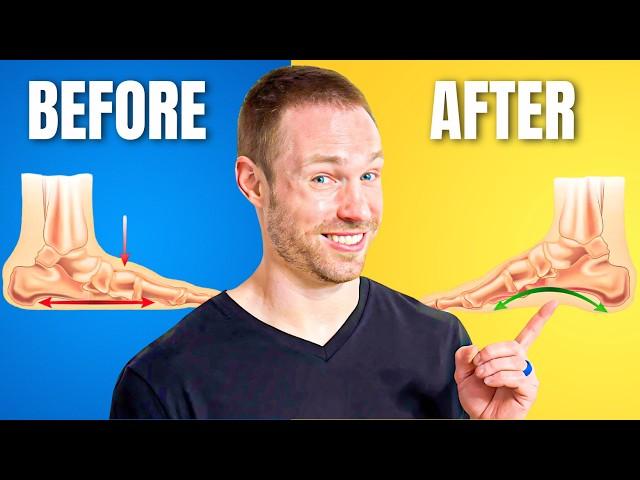 How I Correct Flat Feet (Doctor Explains!)