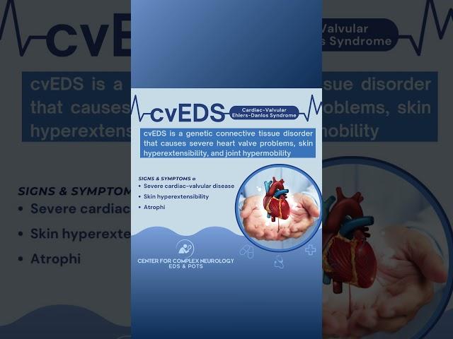 Cardiac-Valvular Ehlers-Danlos Syndrome (cvEDS) Signs & Symptoms - #shorts