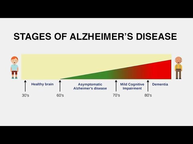 Diagnosing Alzheimer’s Disease