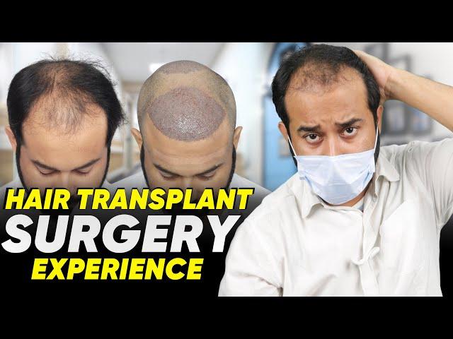 Hair Transplant in Ahmedabad | Best Results & Cost of Hair Transplant in Ahmedabad