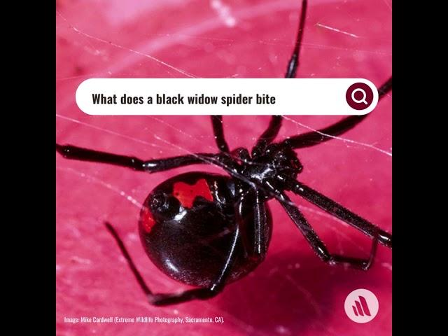 What Does A Black Widow Spider Bite Feel Like?