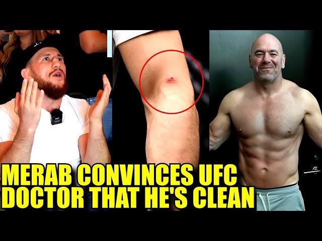 UFC Doctor calls Merab to find out if he really has Staph Infection,Dana White has fake abs?,OMalley