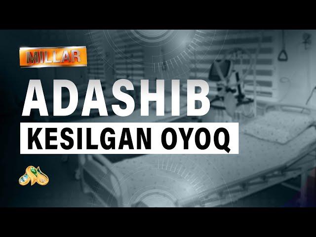 Adashib kesilgan oyoq... Millar