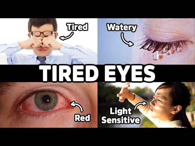 The Vitamin Deficiency behind TIRED and STRAINED EYES