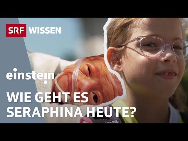 Ein Frühchen damals und heute – Vom Überlebenskampf zur Lebensfreude | Einstein | SRF Wissen