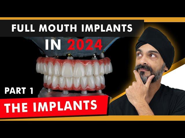 Full Mouth (all on 4) Dental Implants in 2024 - Part 1: The Implants