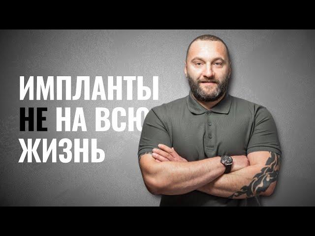  Что такое зубной имплант и нужно ли его устанавливать?