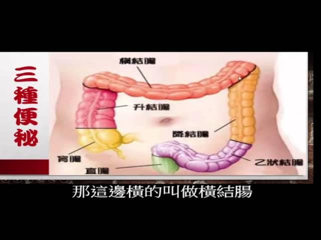 便秘這樣作就對了