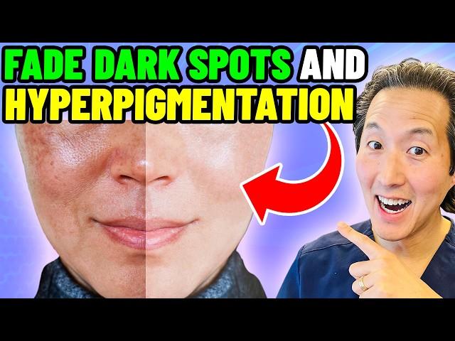 5 Ways to Get Rid of Hyperpigmentation (Melasma and Spots)