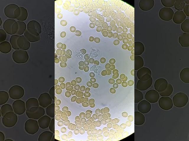 White Blood Cells fighting under microscope!