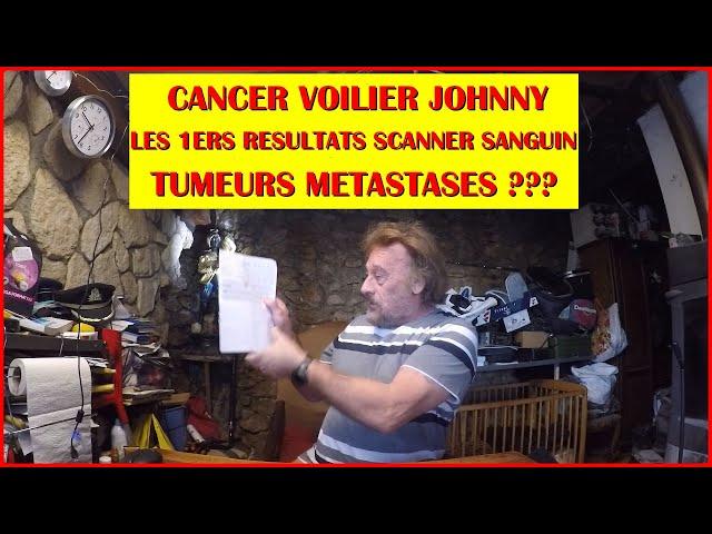 MES 1ERS RESULTATS SCANNER CANCER VOILIER JOHNNY SUN ODYSSEY 29.2  CLABI JOJO