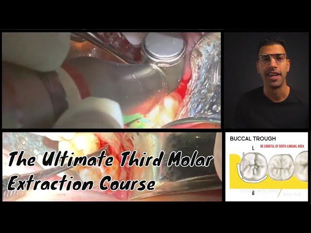 The Third Molar Experience - The Ultimate Wisdom Tooth Extraction Course