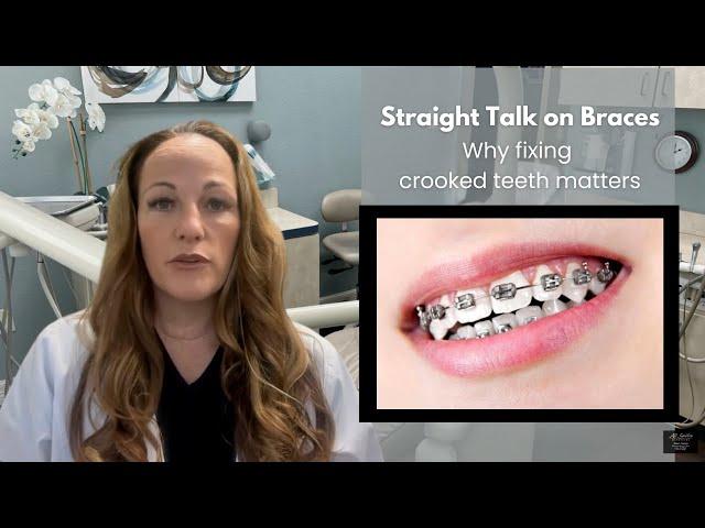 Straight Talk on Braces: Why Fixing Crooked Teeth Matters