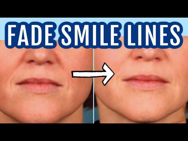 12 ways to fade smile lines (nasolabial folds)| Dr Dray