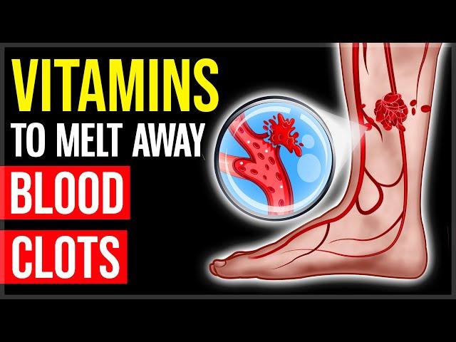 MELT Away Blood Clots With These 10 POWERFUL Vitamins & Foods