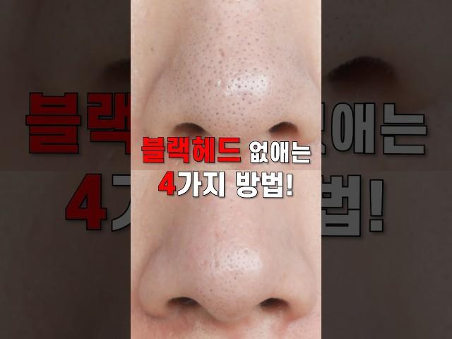 광고 블랙헤드 없애는 방법 4가지️ (효과없으면 구독취소 쌉가능) #shorts #블랙헤드